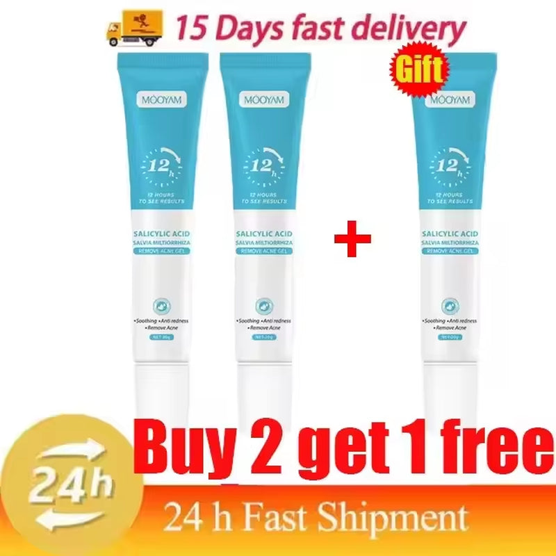 Acne Cream for Face Pimples Remover Treatment Shrink Pores Oil Control Lighten Acne Marks Whitening Smoothing Facial Skin Care