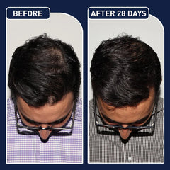 FEG Plus Herbal Hair Growth Mist