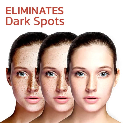 Dark Spot Correcting Cream – Advanced Pigment Removal & Melasma Treatment (EELHOE Original)
