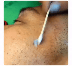 Dark Spot Correcting Cream – Advanced Pigment Removal & Melasma Treatment (EELHOE Original)