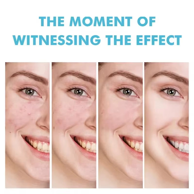Acne Cream for Face Pimples Remover Treatment Shrink Pores Oil Control Lighten Acne Marks Whitening Smoothing Facial Skin Care